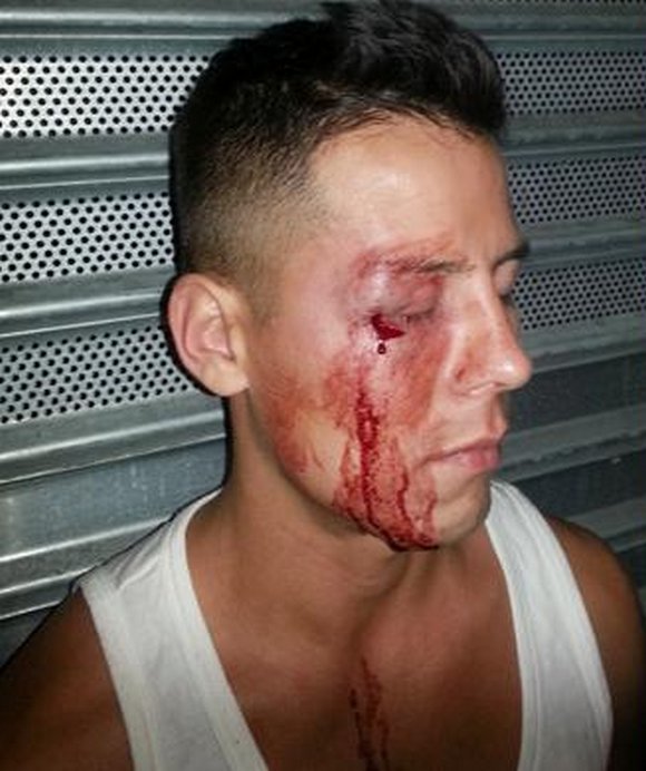 Gay assault in new york Tranny Bianca Hills